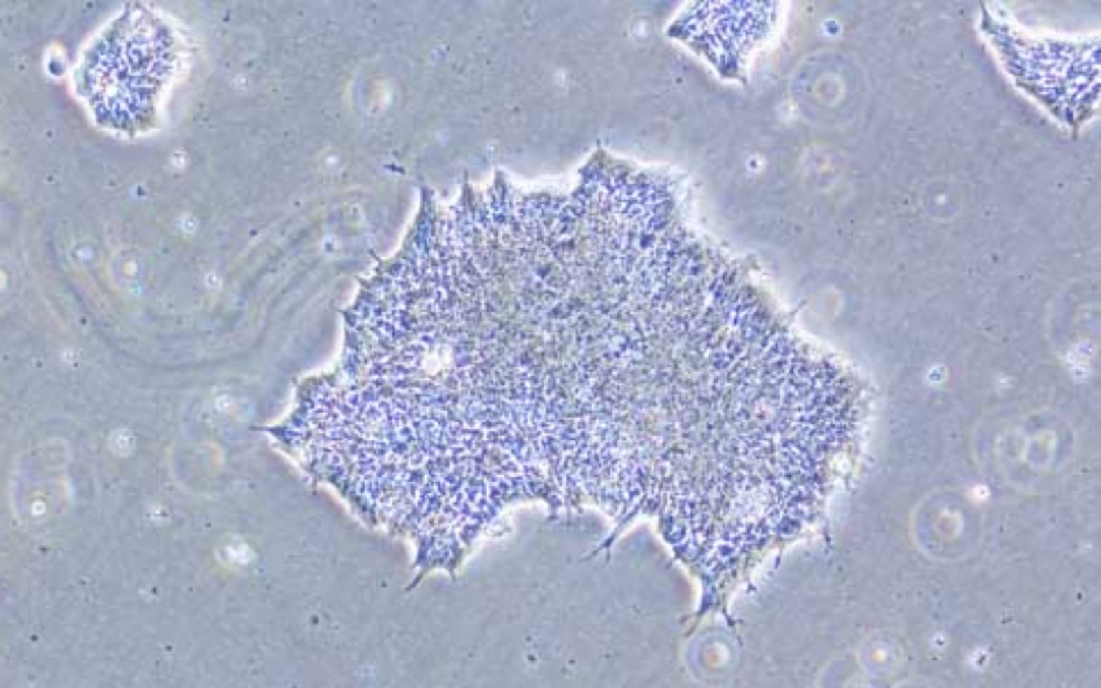 Ingrid-Knarston_cell-image-CNEW-1600×1000-1