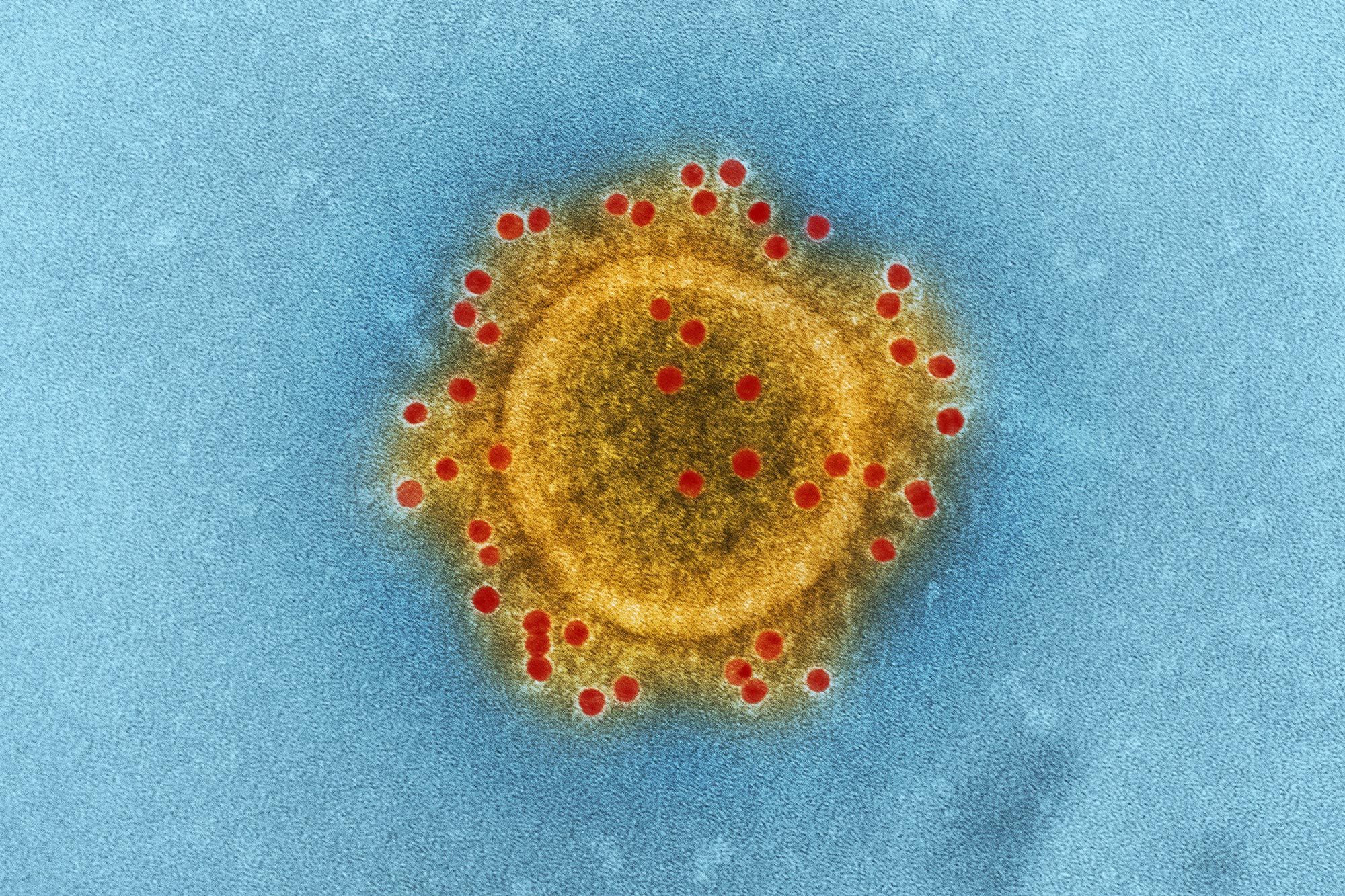 ITB Berlin cancelled, France bans all large events due to coronavirus